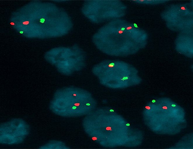 荧光原位杂交(FISH)技术在临床中的应用
