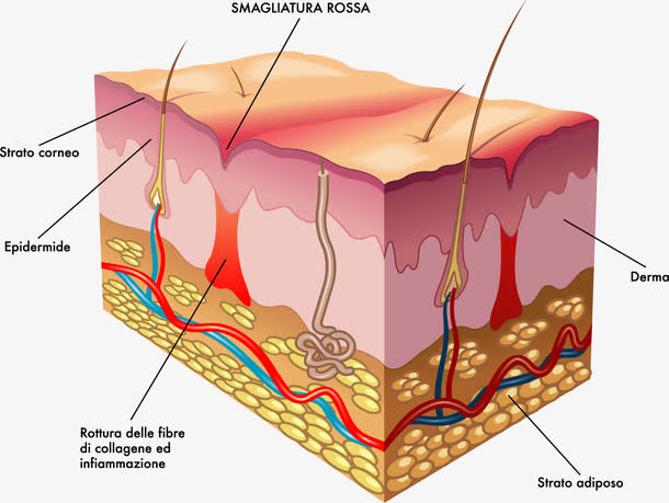 皮肤的基本结构